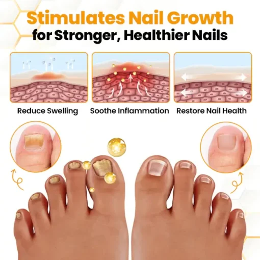 Cvreoz® BeeVenom Anti-Fungal Nail Renewal Oil