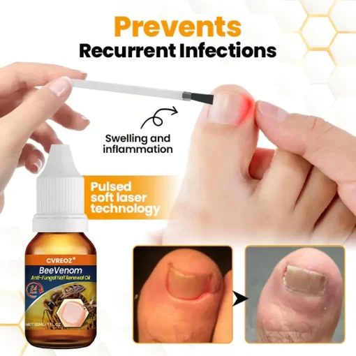 Cvreoz® BeeVenom Anti-Fungal Nail Renewal Oil