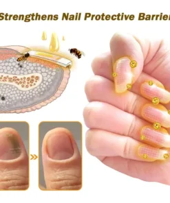 Cvreoz® BeeVenom Anti-Fungal Nail Renewal Oil