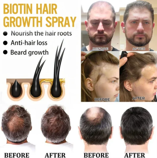 Cvreoz® Biotin Hair Essential Oil