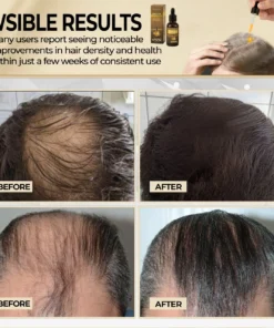Cvreoz® Biotin Hair Essential Oil
