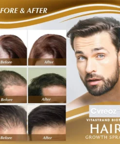 Cvreoz® Biotin Hair Essential Oil