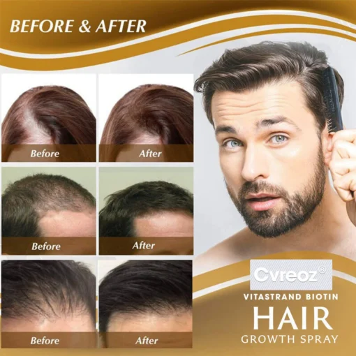 Cvreoz® Biotin Hair Essential Oil
