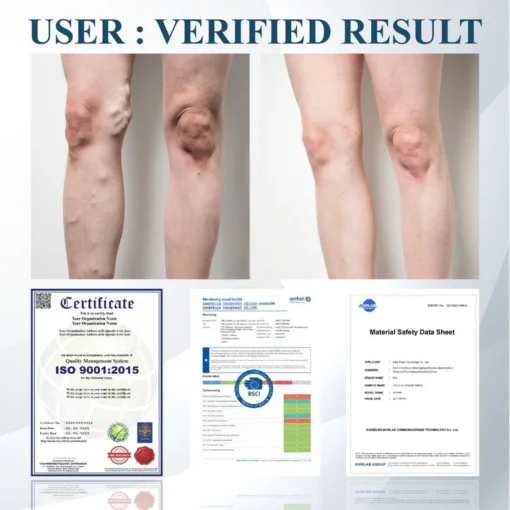 Cvreoz® Black Cumin Edema Soothing Herbal Cream