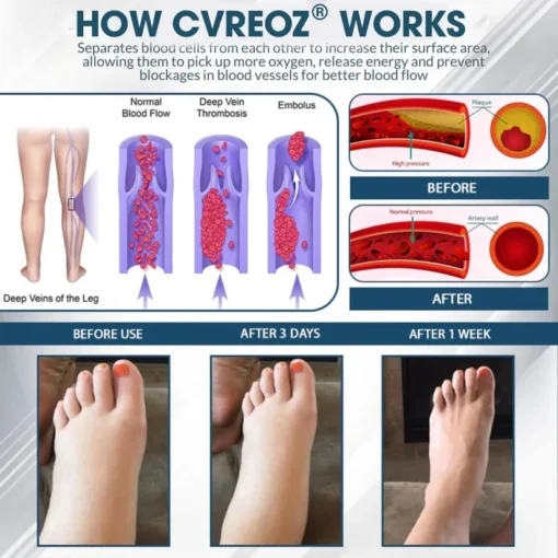 Cvreoz® Black Cumin Edema Soothing Herbal Cream