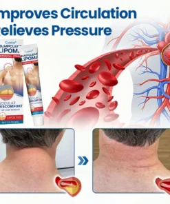 Cvreoz® BumpClear Lipoma Removal Cream