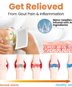 Cvreoz® Colchicine Nano-Needles Patches for Gout Care
