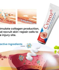 Cvreoz® Diabetic Foot Healing Cream