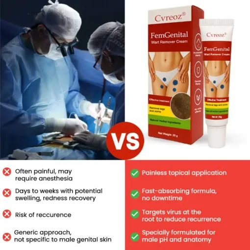 Cvreoz® FemGenital Wart Remover Cream