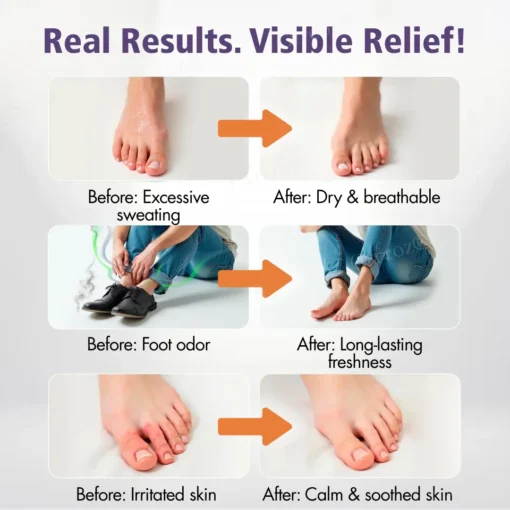 Cvreoz® Foot Odor Removal and Antiperspirant Spray
