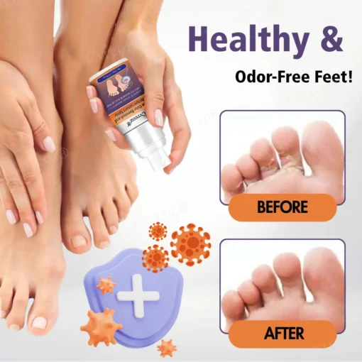 Cvreoz® Foot Odor Removal and Antiperspirant Spray