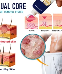Cvreoz® Genital Warts Remover Cream