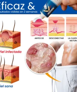 Cvreoz® GentX Crema Alivio