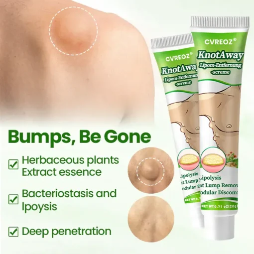 Cvreoz® KnotAway Lipoma Removal Cream