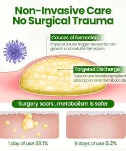 Cvreoz® KnotAway Lipoma Removal Cream