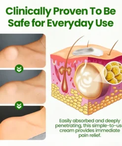 Cvreoz® KnotAway Lipoma Removal Cream