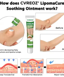 Cvreoz® LipomaCure Soothing Ointment