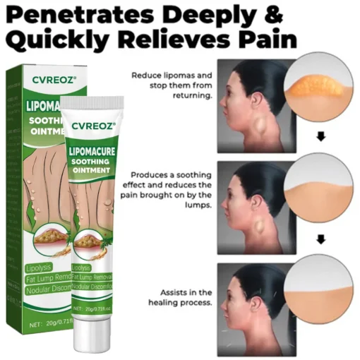 Cvreoz® LipomaCure Soothing Ointment