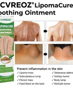 Cvreoz® LipomaCure Soothing Ointment