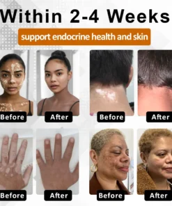 Cvreoz® MelanoCare Skin Rebalancing VitiBee Cream