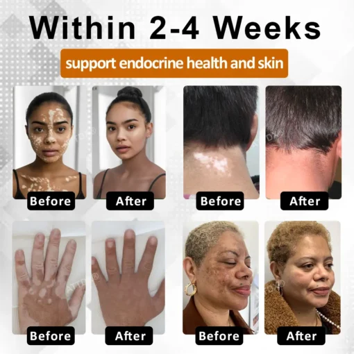 Cvreoz® MelanoCare Skin Rebalancing VitiBee Cream