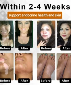 Cvreoz® MelanoCare Skin Rebalancing VitiBee Cream