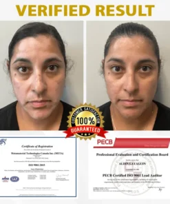 Cvreoz® MelanoCare Skin Rebalancing VitiBee Cream