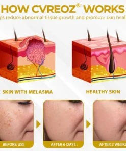 Cvreoz® MelanoCare Skin Rebalancing VitiBee Cream