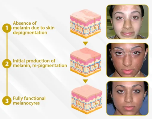 Cvreoz® MelanoCare Skin Rebalancing VitiBee Cream