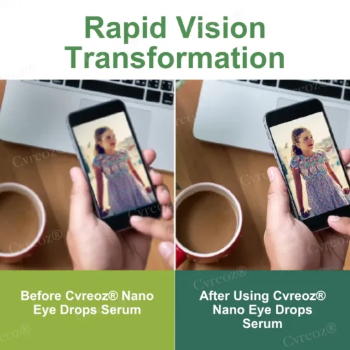 Cvreoz® Nano Eye Drops Serum