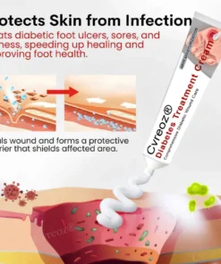 Cvreoz® Natural Lipoma Removal Cream