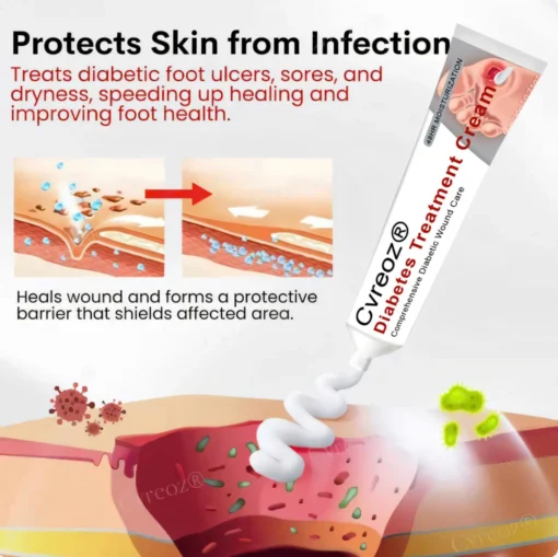 Cvreoz® Natural Lipoma Removal Cream