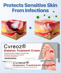 Cvreoz® Natural Lipoma Removal Cream