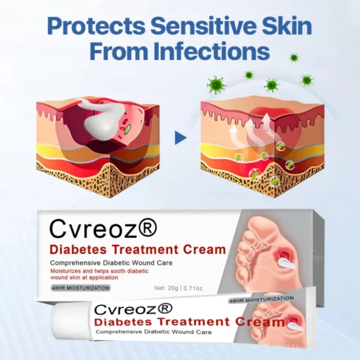 Cvreoz® Natural Lipoma Removal Cream