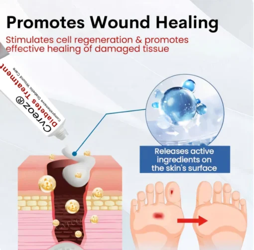Cvreoz® Natural Lipoma Removal Cream
