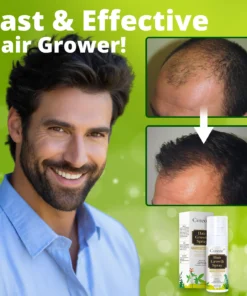 Cvreoz® Nourish & Flourish Hair Growth Spray + 5%Minoxidil