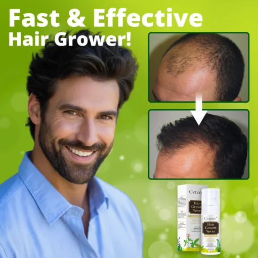 Cvreoz® Nourish & Flourish Hair Growth Spray + 5%Minoxidil