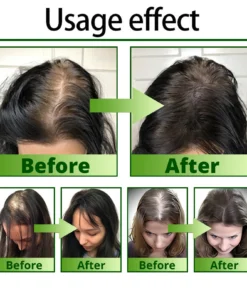 Cvreoz® Nourish & Flourish Hair Growth Spray + 5%Minoxidil