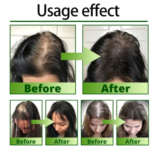 Cvreoz® Nourish & Flourish Hair Growth Spray + 5%Minoxidil