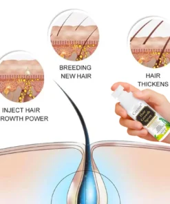 Cvreoz® Nourish & Flourish Hair Growth Spray + 5%Minoxidil