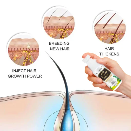 Cvreoz® Nourish & Flourish Hair Growth Spray + 5%Minoxidil