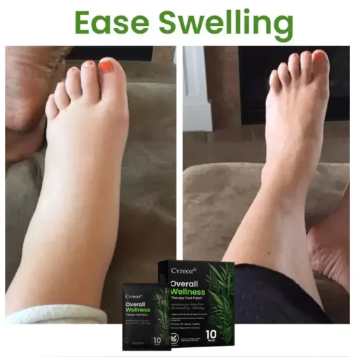 Cvreoz® Overall Wellness Therapy Foot Patch
