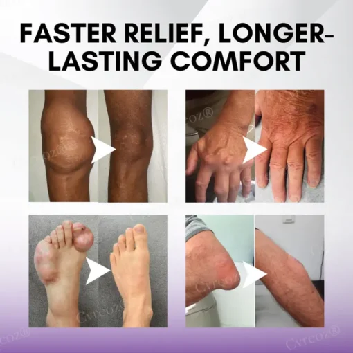 Cvreoz® Turmeric & Emu Oil Arthritis Soothing Pain Relief Massage Gel