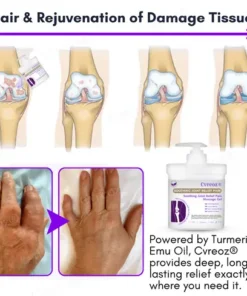 Cvreoz® Turmeric & Emu Oil Arthritis Soothing Pain Relief Massage Gel