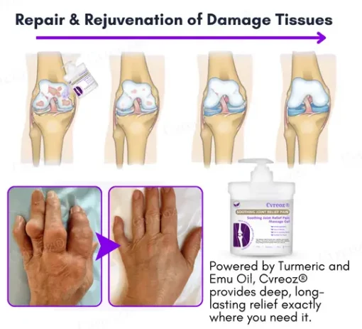 Cvreoz® Turmeric & Emu Oil Arthritis Soothing Pain Relief Massage Gel