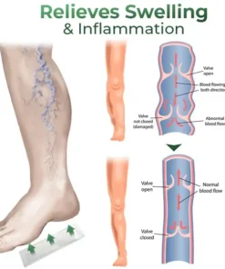 Cvreoz® Varicose Vein Relief Herbal Foot Patch