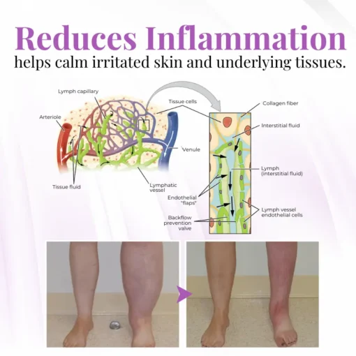 Cvreoz® VascuSoothe Leg Care Phyto Cream