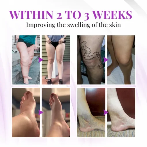 Cvreoz® VascuSoothe Leg Care Phyto Cream
