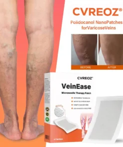 Cvreoz® VeinEase Microneedle Therapy Patch
