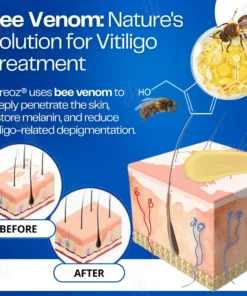Cvreoz® VitiClear Bee Venom Cream
